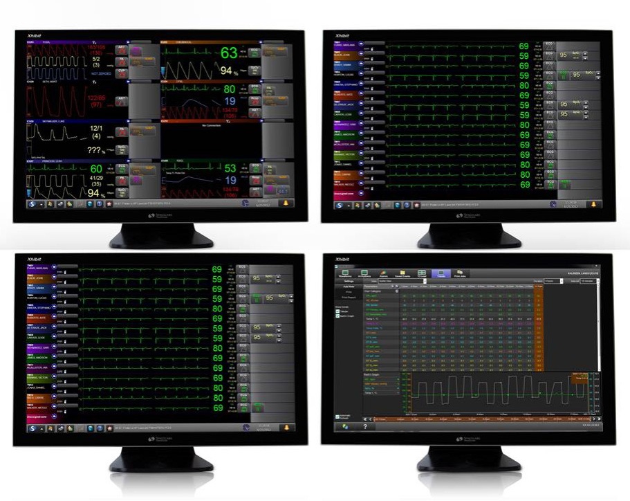 SPACELABS centrální monitor Xhibit