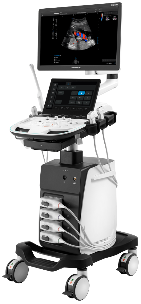 SonoScape P12 Elite – ultrazvukový přístroj